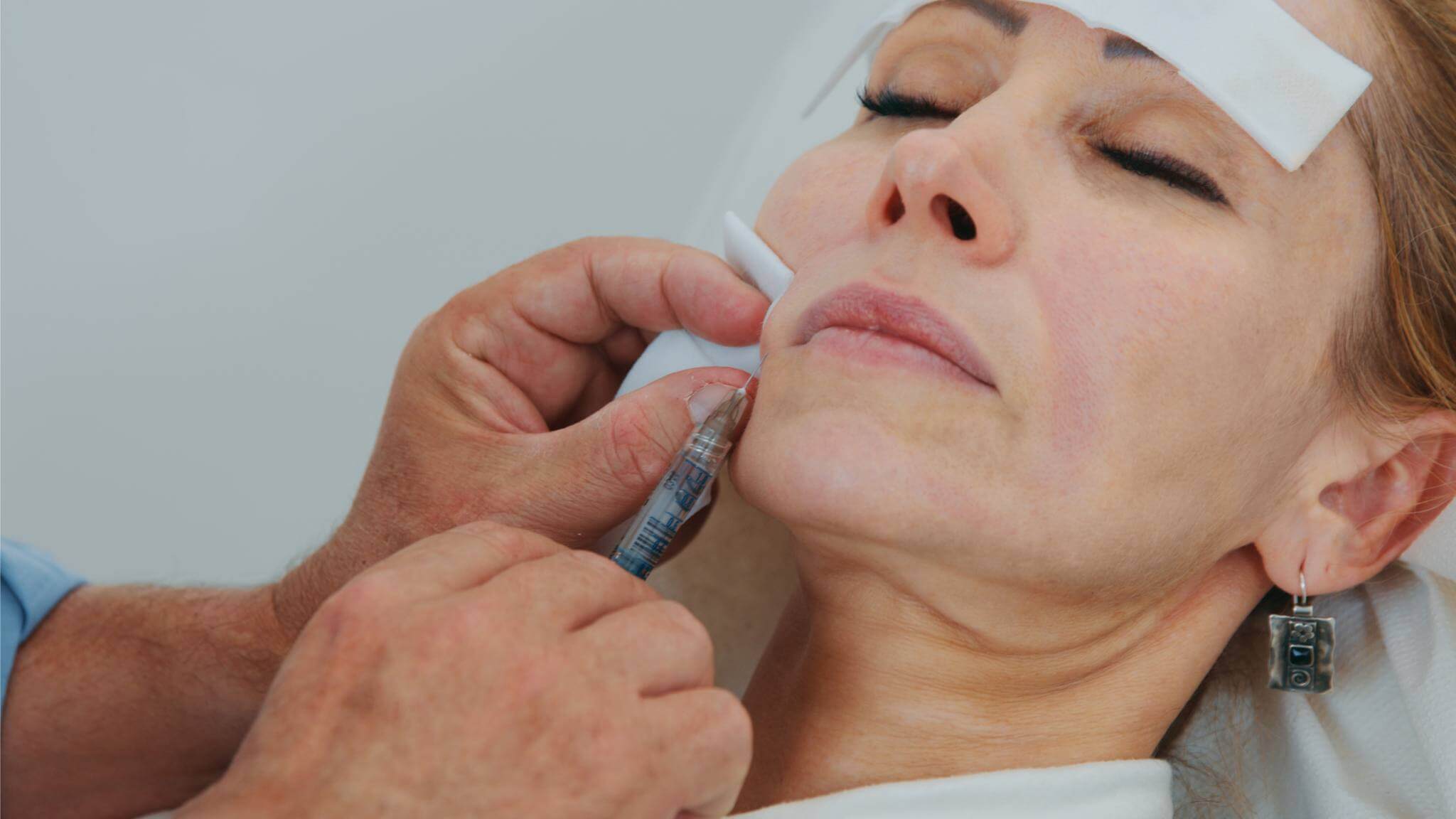 natural-looking-results-with-profhilo_1